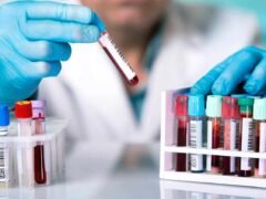 Laboratorios en Saltillo