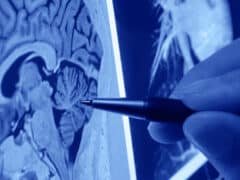 Neurologos en Saltillo