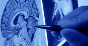 Neurólogos en Saltillo 3